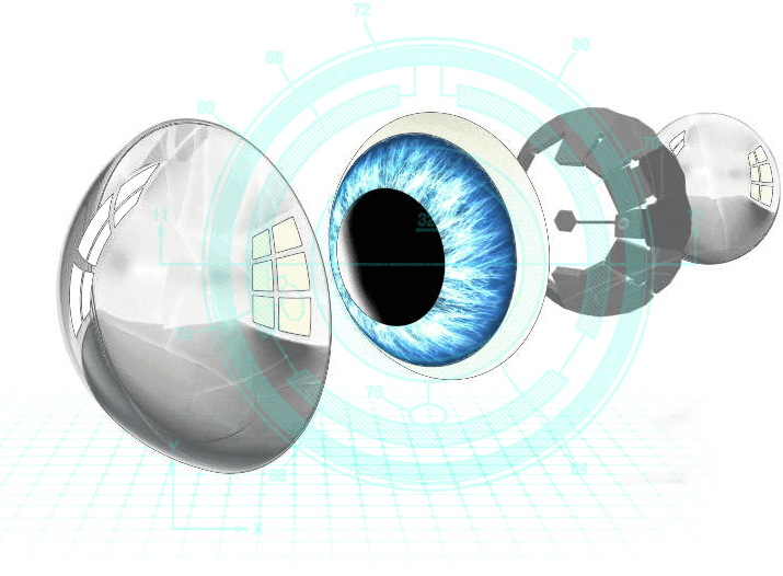 Eye disassembled